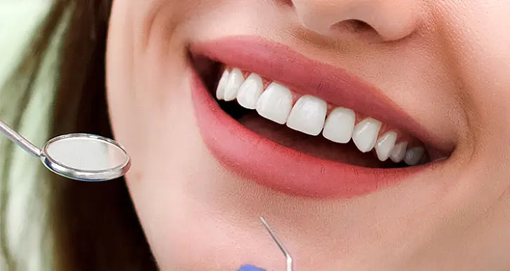 مراقبت از لمینت دندان